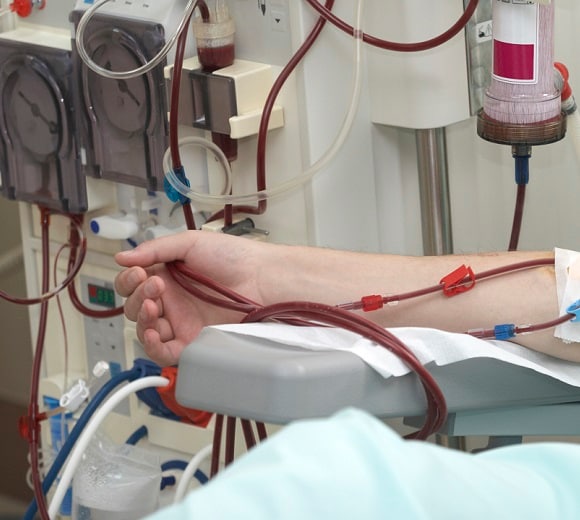 The little known alternative to dialysis - Temasek